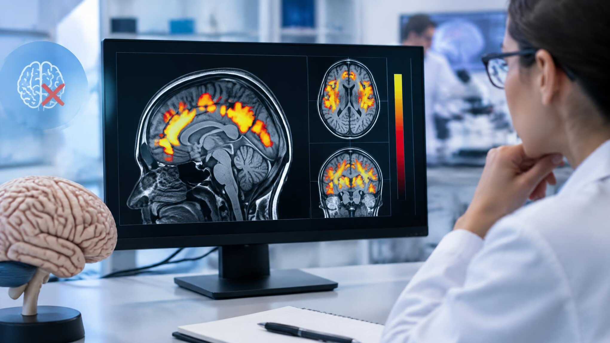 brain scan evidence